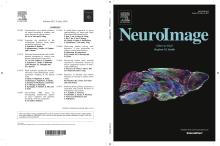 NeuroImage chooses figure from Stephanie Crater's Paper for July Cover!